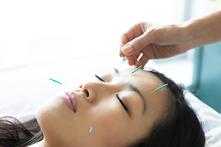 Subsequent Acupuncture (45 to 60 min/$100)